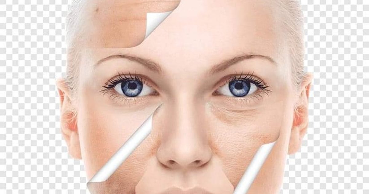 پوستکی یا جلد ساتنه