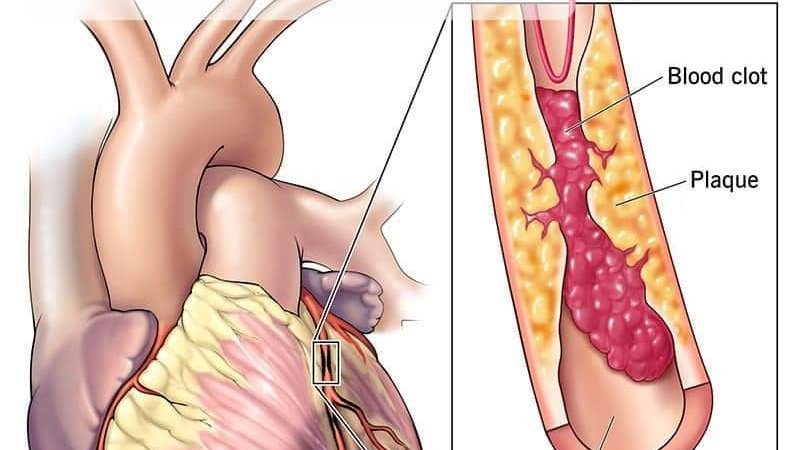 زړه او رګونو ناروغيو عام اعراض