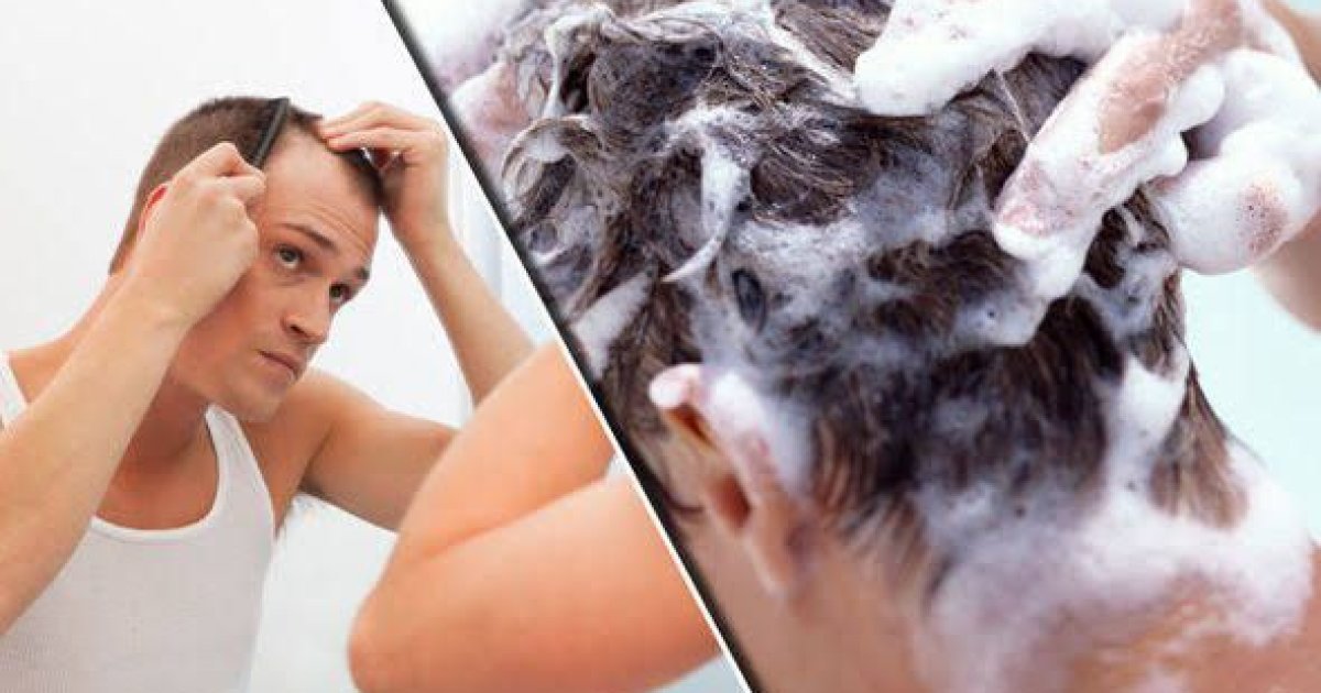 وېښتانو توېدل