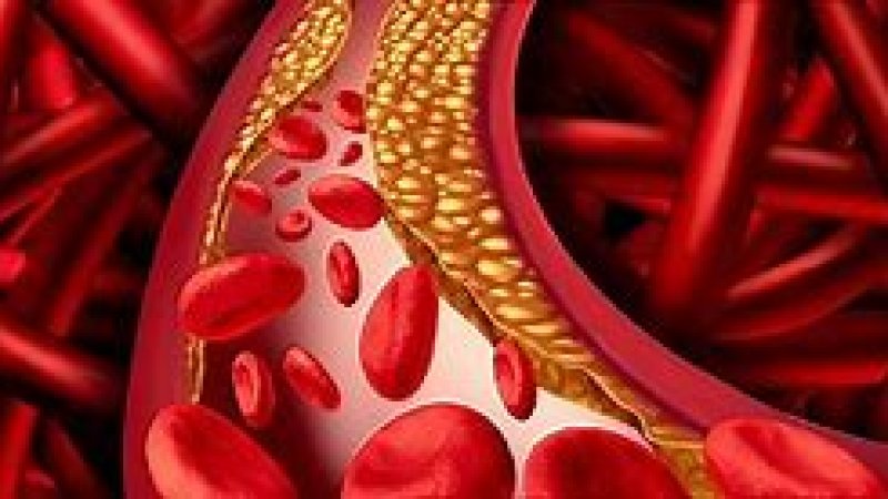 کولیسټرول Cholestrole