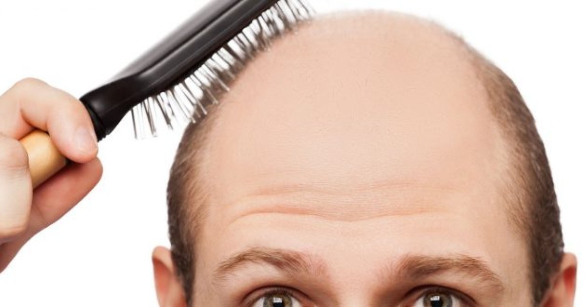 که مو ویښتان تویږي دا درې خواړه وخورئ