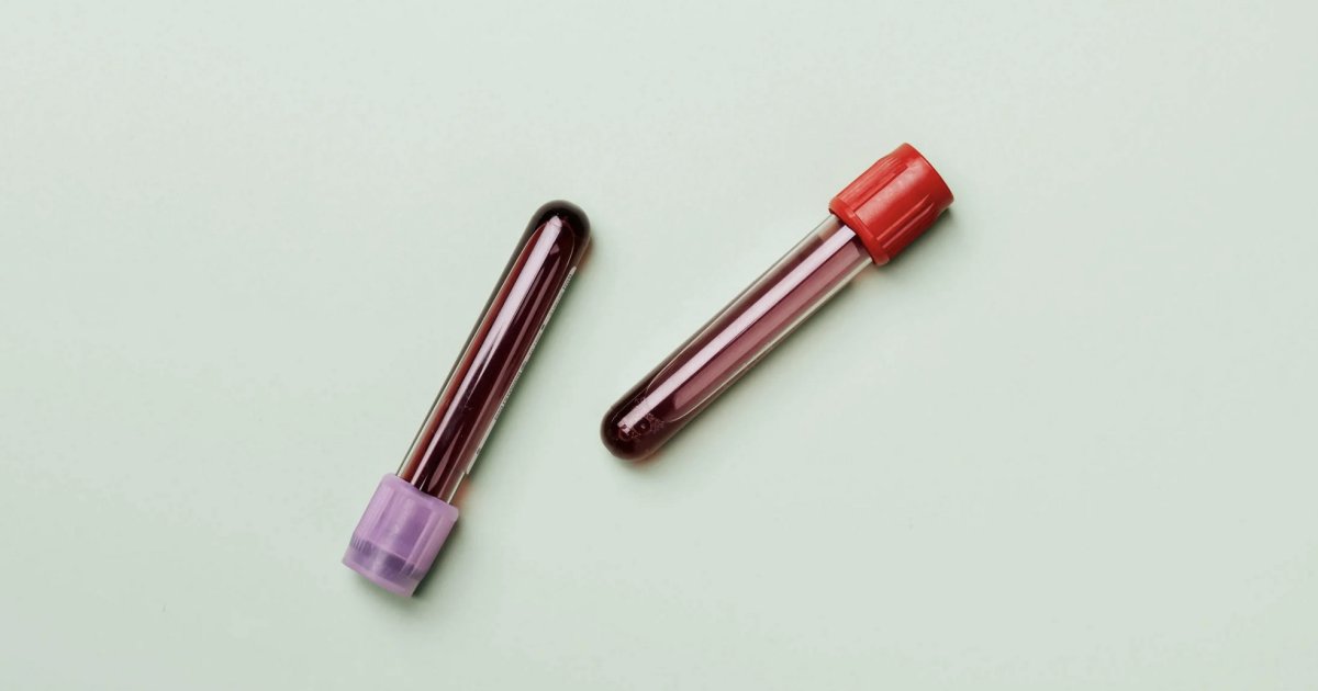 که له وینې څخه وېرېږئ، دا رواني ناروغي لرئ!