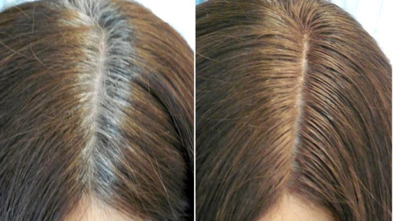 له وخت څخه مخکي مو ويښتان ولي سپينږي درملنه يې څه ده؟