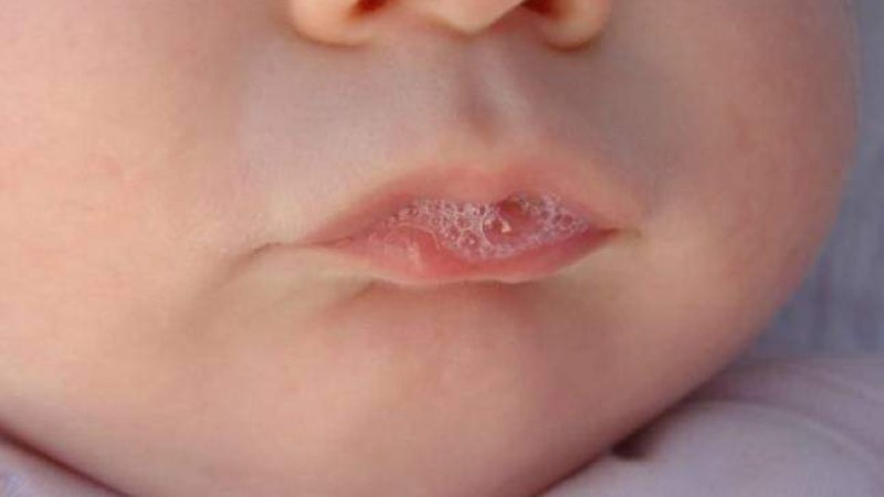 لاړې څه ته ويل کېږي؟