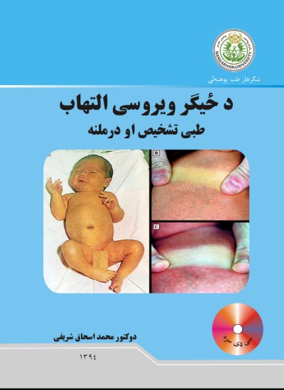 د ځیګر ویروسی التهاب