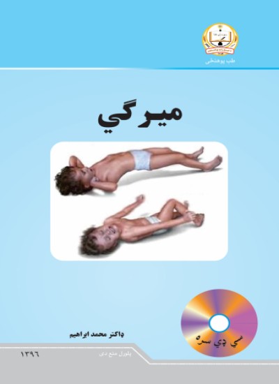 میرګی